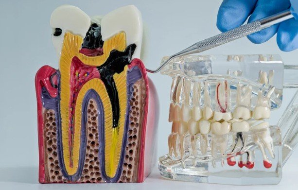Enhancing Oral Hygiene and Preventing Decay